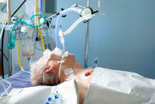 Intubated adult white man under AVL lying in coma in intensive care department